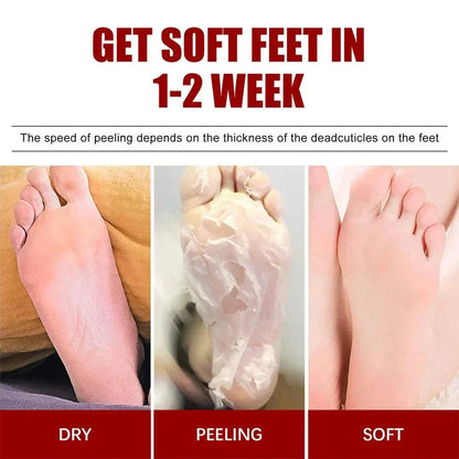 Nomilora Exfoliating Foot Mask results showing dry, peeling, and soft feet stages within 1-2 weeks.